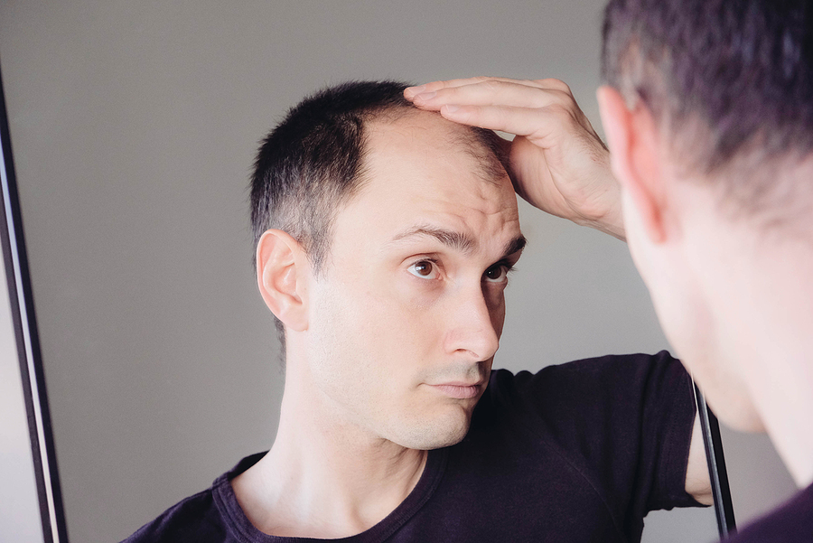 Man getting effective hair loss treatments